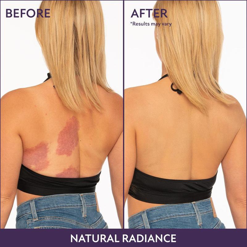 ✨ Body Coverage Perfector: maquillaje corporal resistente al agua, ligero e impecable