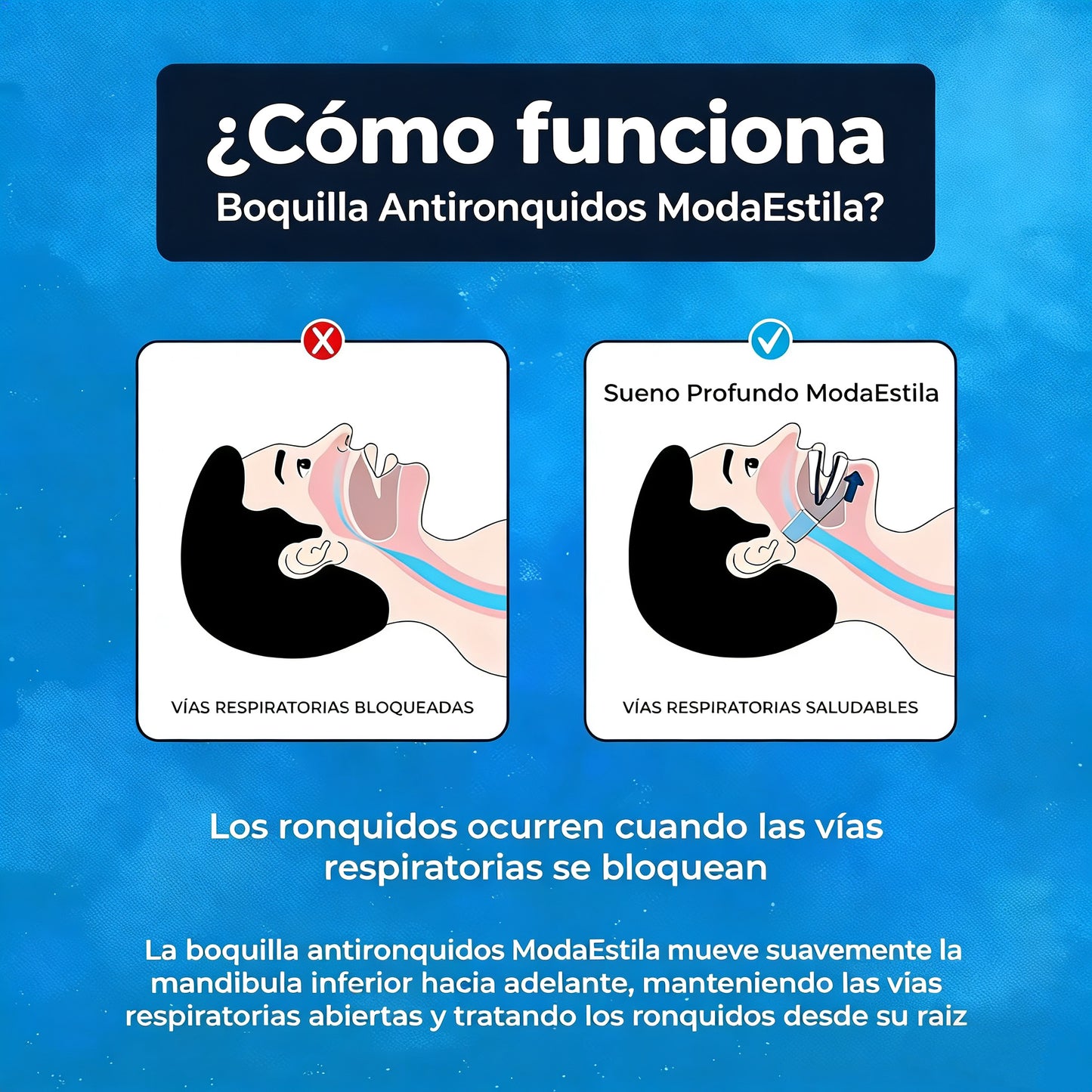 Boquilla antironquidos ModaEstila™